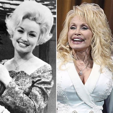 dolly parton natural breasts|Dolly Parton Explains Which Cosmetic Procedures。